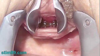 Masturbate Peehole less Toothbrush and Cablegram into Urethra